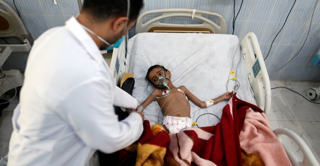 BM: "Yemen'de 18 milyon kişi açlık tehdidi ile karşı karşıya"