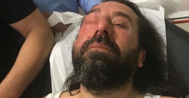 İYİ Parti kurucularından Metin Bozkurt'a MHP'liler tarafından saldırı yapıldı