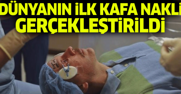 İtalyan Profesör Canavero Çin'de gerçekleştirdi