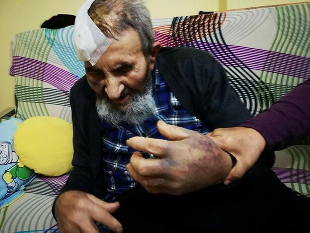 İnsanlık ayaklar altında! 93 yaşındaki adamı öldüresiye dövüp gasp ettiler