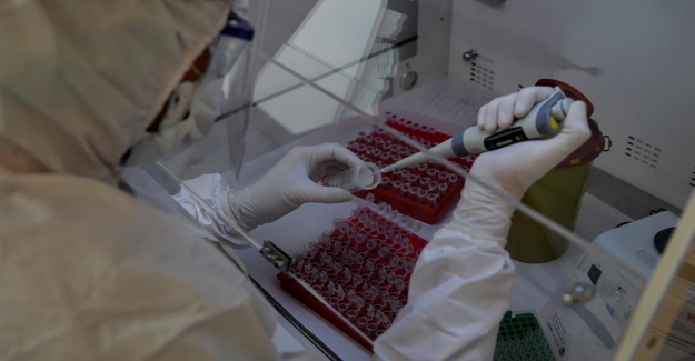 Kovid-19’un yeni bir belirtisi tespit edildi: Cilt dökülmesi