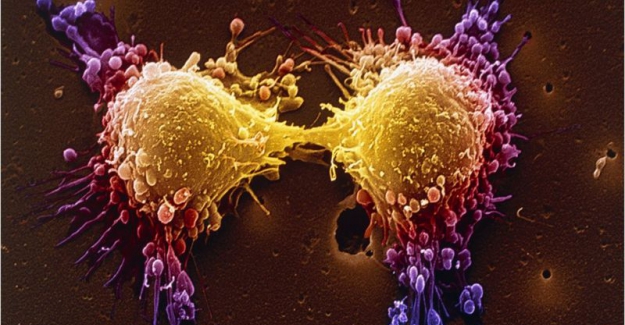 4 Şubat Dünya Kanser Günü: Covid salgını, kanserle mücadeleyi nasıl etkiledi?