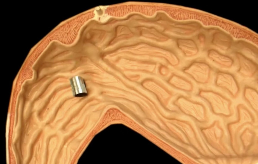 İnsan vücudu içinde yüzebilen minik bir robot geliştirildi