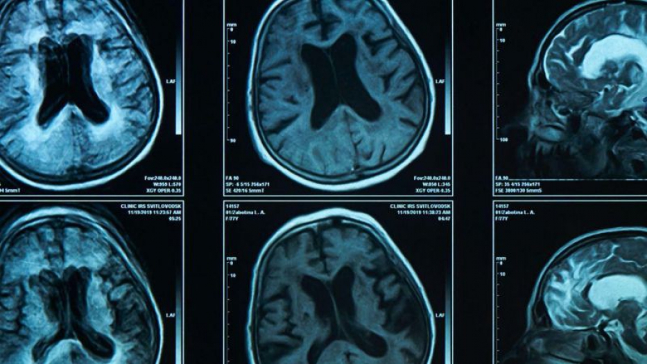 Yaşın ilerlemesi siyaset yapmaya engel mi?