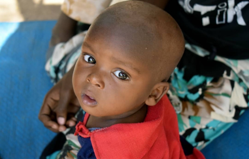 Sudan'da 2 bin 500 kanser hastası çocuk yerinden edilerek ölüme terk ediliyor