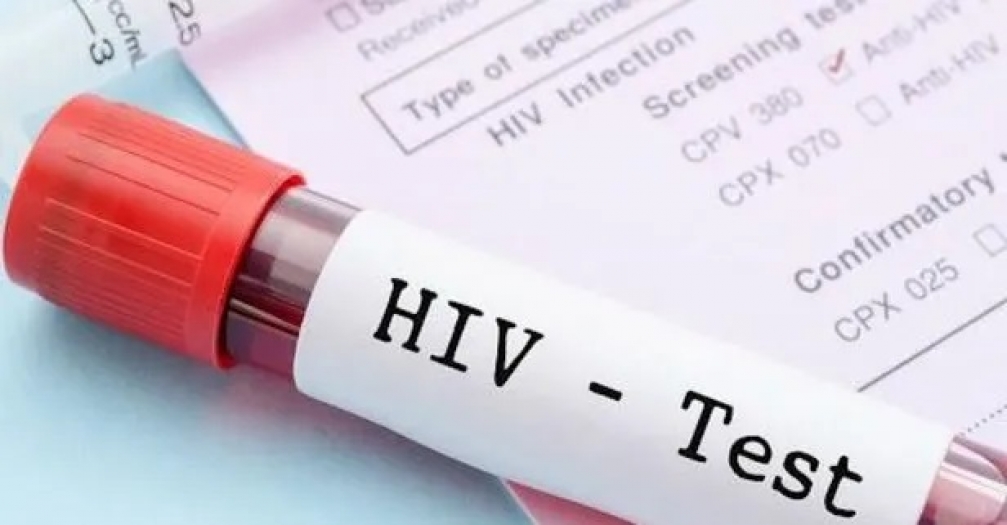 Karabük İl Sağlık Müdürlüğü, Afrikalı öğrenciler nedeniyle HIV ve HPV pozitif vakalarında artış iddialarını yalanladı