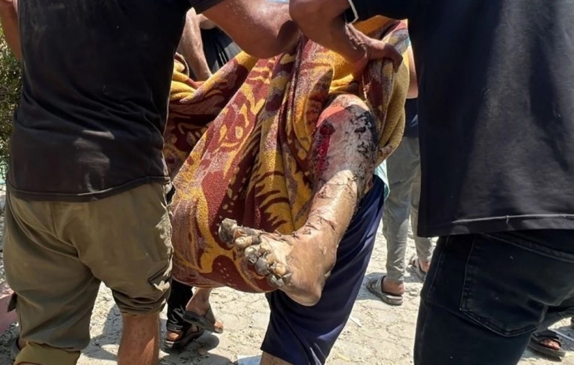 ABD'den destek gören İşgalci İsrail sivil katliamına hız verdi; Deyr Belah'taki okul hastanesinde 31 sivil şehit