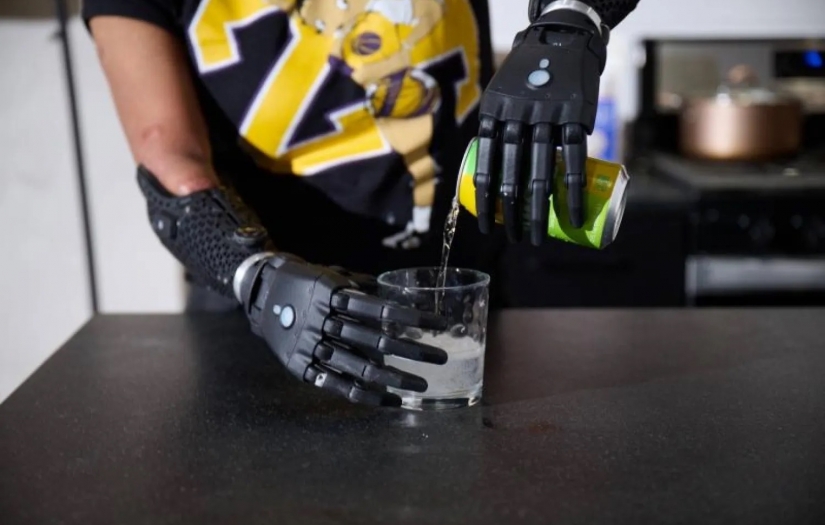 Dünyanın en gelişmiş biyonik eli: Koldan ayrılıp kendi başına hareket ediyor