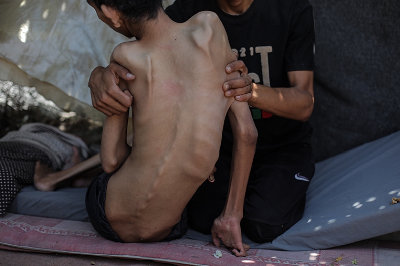 Soykırımın yeni yüzü: Kıtlık