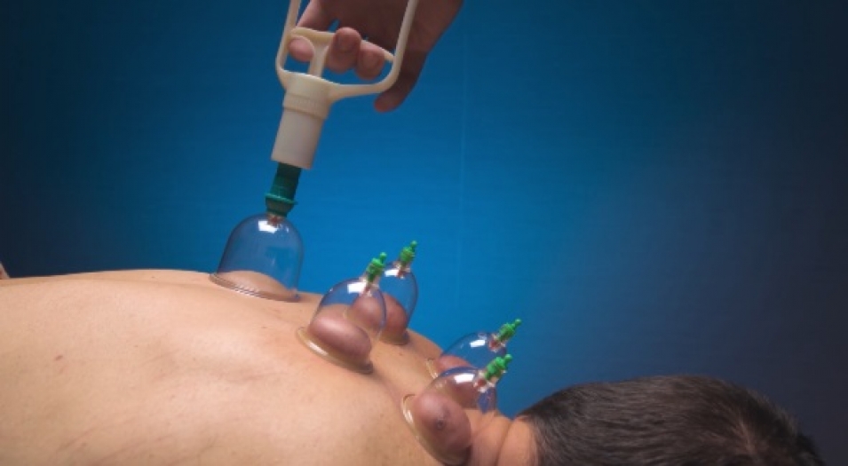 4 bin yıllık tıp geleneği: Kupa tedavisi