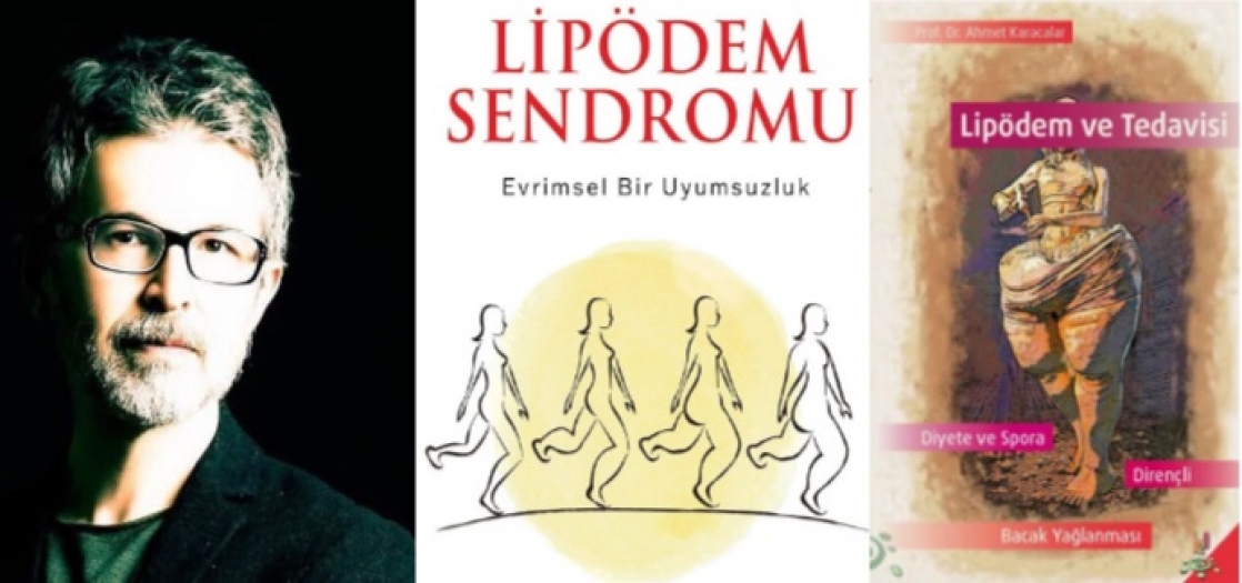 Prof. Dr. Ahmet Karacalar uyardı: "Kilo veremiyorsanız suçlu iradeniz değil, ‘Lipödem’ olabilir.."