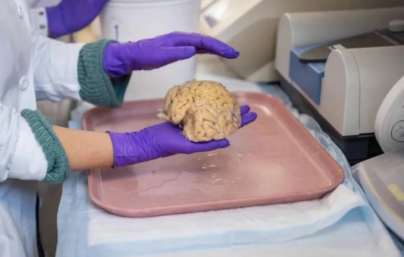 Süper yaşlıların beyninin "gizli bileşeni" tespit edildi