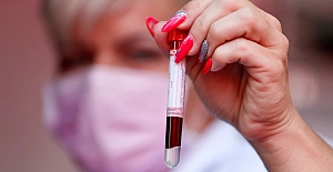 İngiltere’de Kanseri Kan Testiyle Erken Teşhis Olasılığı