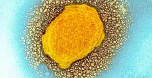 Maymun çiçeği virüsü: Endişelenmeli miyiz yoksa görmezden mi gelmeliyiz?