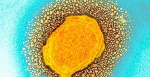 TTB’den maymun çiçeği açıklaması: Yine vaka görülene kadar hiçbir adım atmayan bir Sağlık Bakanlığı!