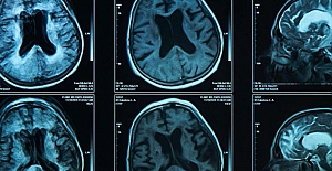 Yaşın ilerlemesi siyaset yapmaya engel mi?