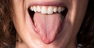 Dik renginiz hastalık habercisi olabilir