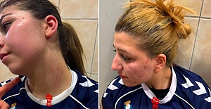 Şanlıurfa Kadın Hentbol Takımı'nı karşı takımın erkek taraftarları darbetti!