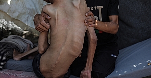 Soykırımın yeni yüzü: Kıtlık