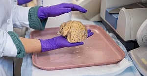 Süper yaşlıların beyninin "gizli bileşeni" tespit edildi