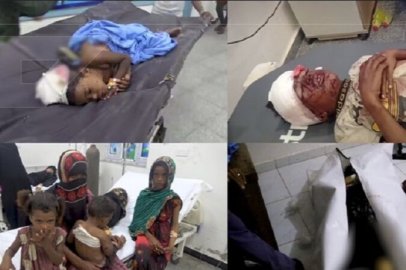 Dünya Sağlık Örgütü: Yemen’de bin 677 kişi hayatını kaybetti